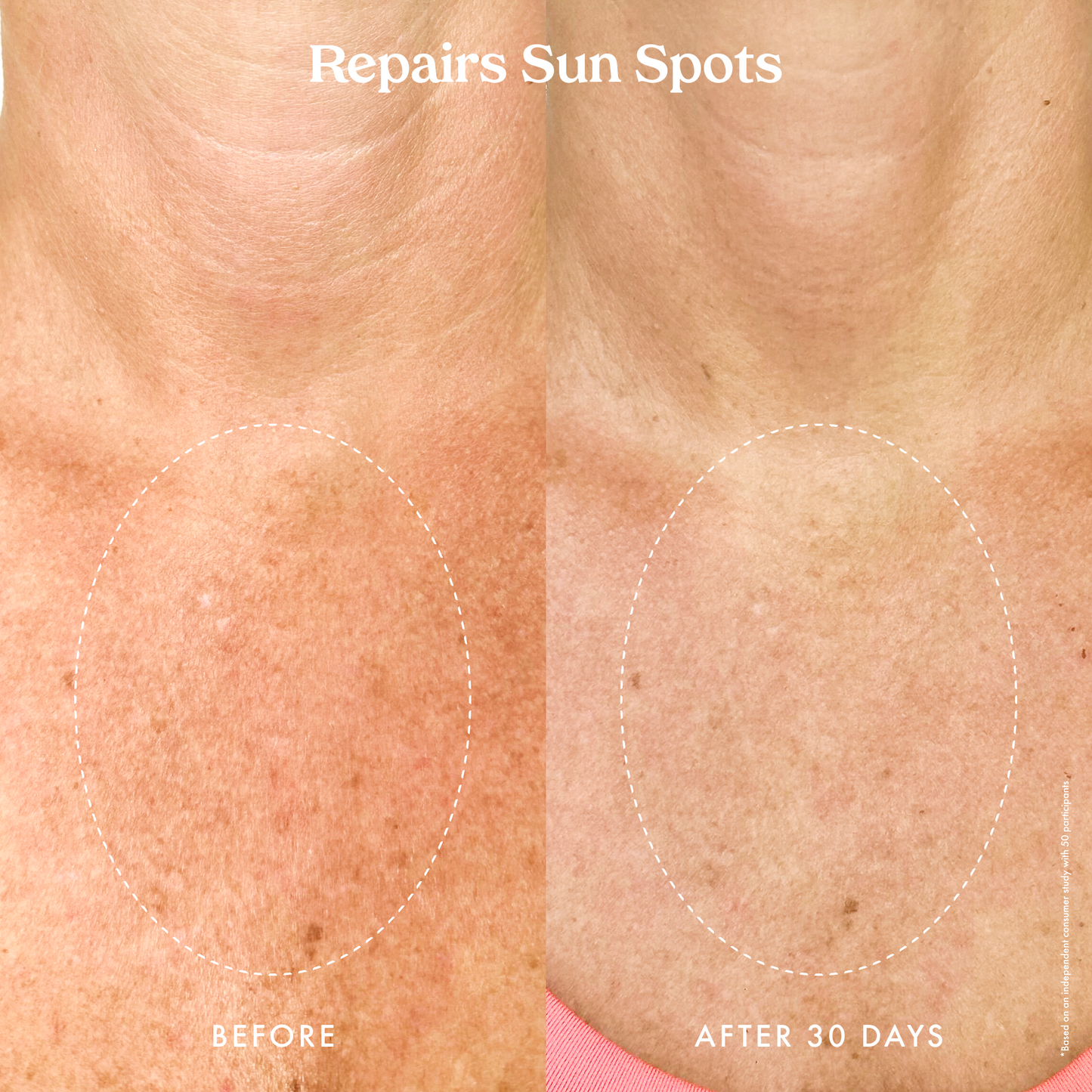 MINI Ultra Renewal Retinol Body Cream