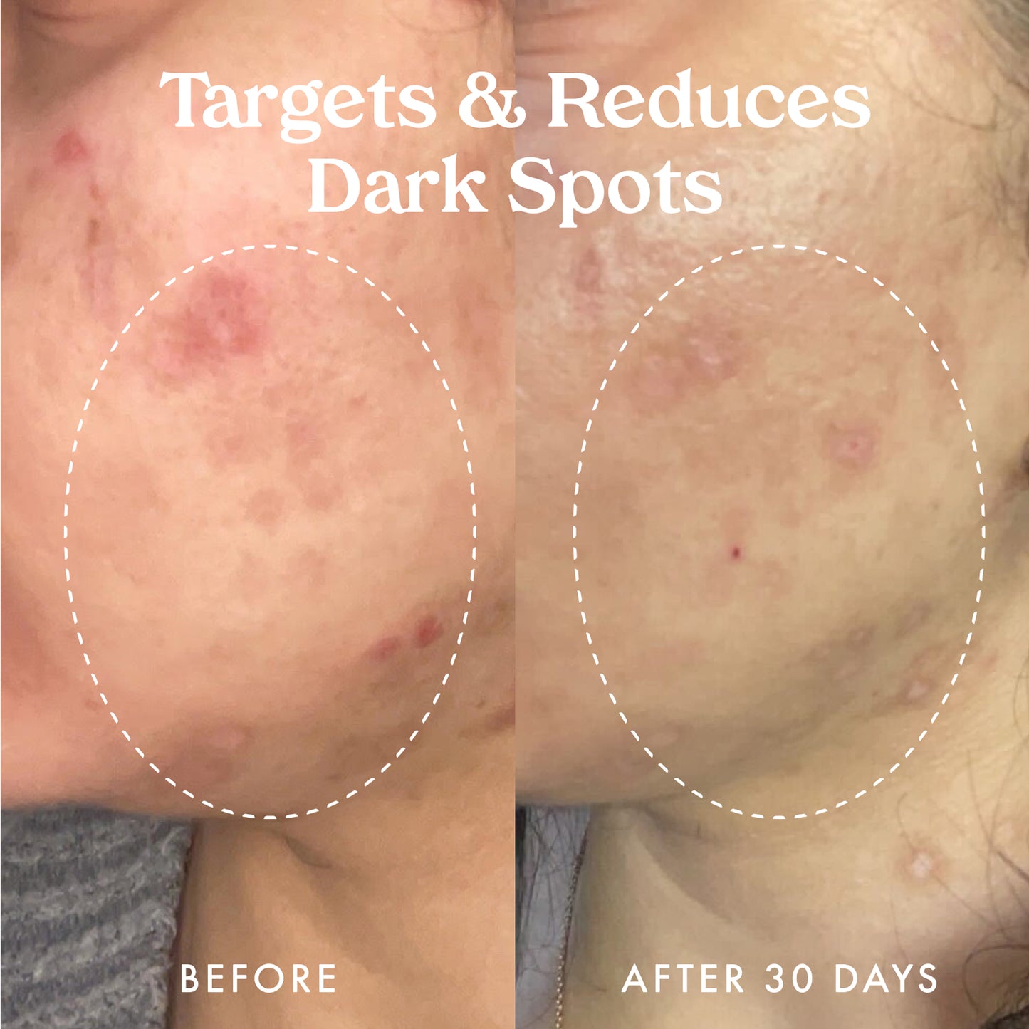 Star Bright Vitamin C Discoloration Correcting Serum