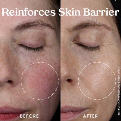 Nourishing Hydro-Lipid Barrier Serum